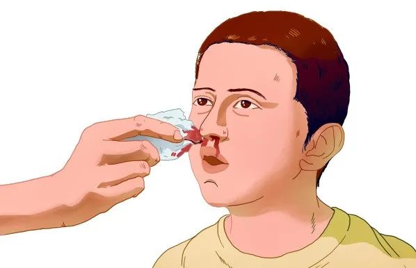 湖南益安生物 | 鼻腔专用止血海绵，国产高端止血材料